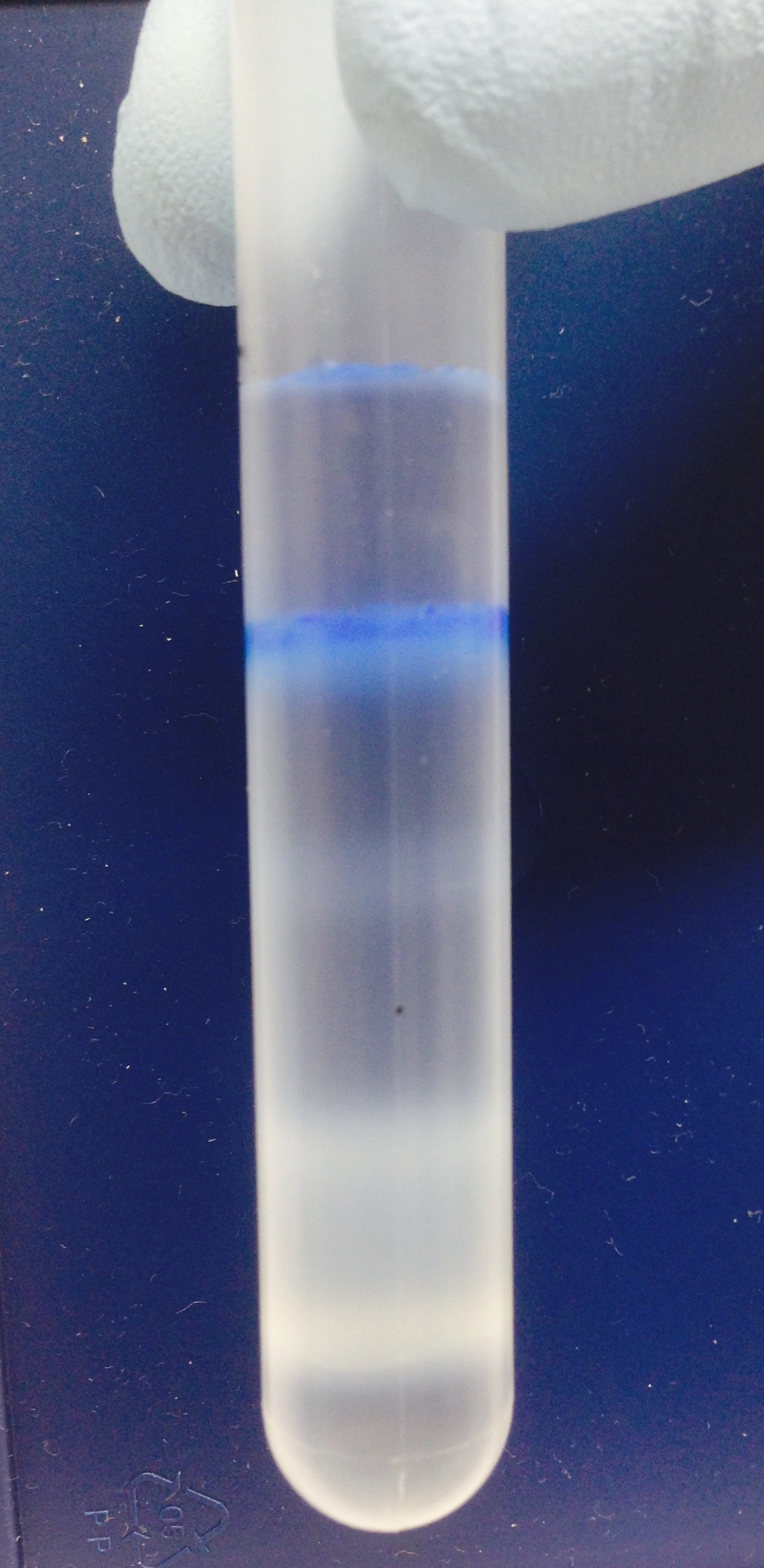 Phagosome Gradient